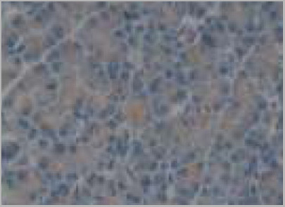 product-image-AAA20897_IHC3.jpg