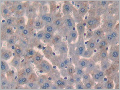 product-image-AAA20901_IHC5.jpg