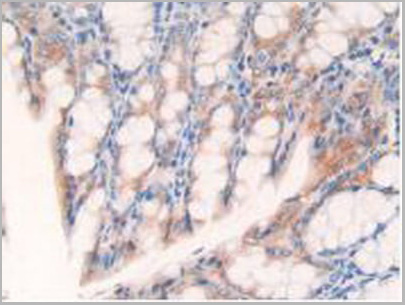product-image-AAA20901_IHC6.jpg