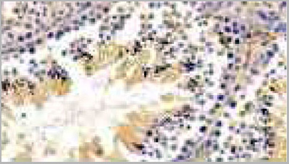 product-image-AAA20911_IHC3.jpg