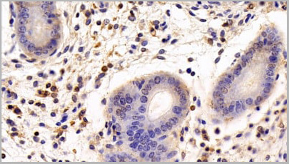 product-image-AAA20918_IHC3.jpg