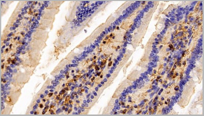 product-image-AAA20918_IHC4.jpg