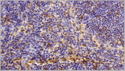 product-image-AAA20918_IHC6.jpg