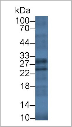 product-image-AAA20918_WB2.jpg