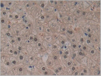 product-image-AAA20921_IHC4.jpg