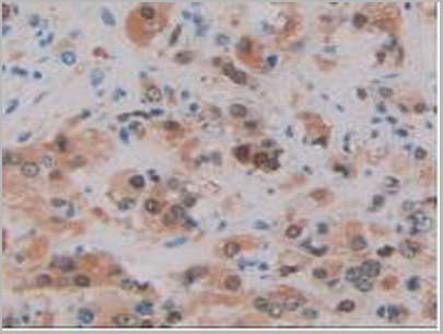 product-image-AAA20921_IHC5.jpg