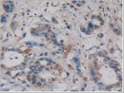product-image-AAA20925_IHC3.jpg