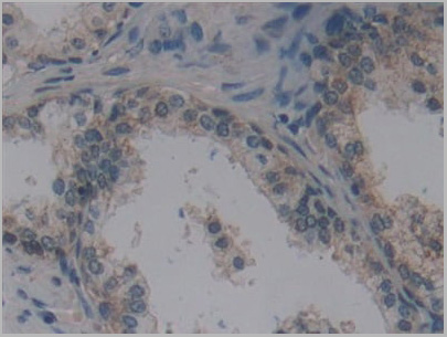 product-image-AAA20925_IHC4.jpg