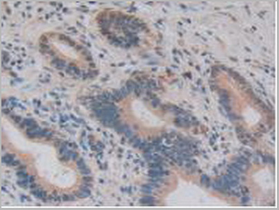 product-image-AAA20925_IHC5.jpg