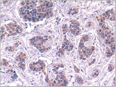 product-image-AAA20927_IHC3.jpg