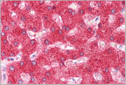 product-image-AAA20927_IHC4.jpg