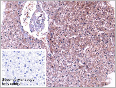 product-image-AAA20927_IHC5.jpg
