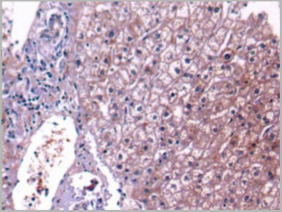 product-image-AAA20927_IHC6.jpg