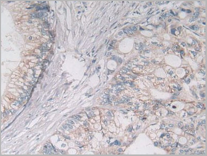 product-image-AAA20928_IHC3.jpg