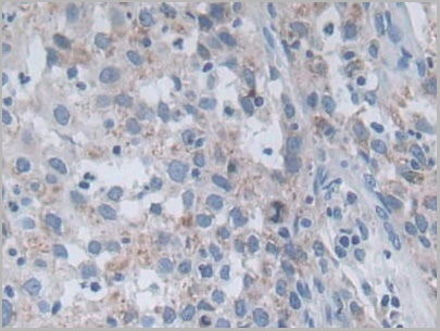 product-image-AAA20928_IHC4.jpg
