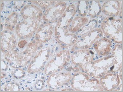 product-image-AAA20928_IHC5.jpg
