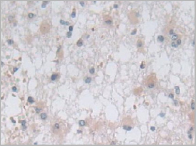 product-image-AAA20928_IHC6.jpg