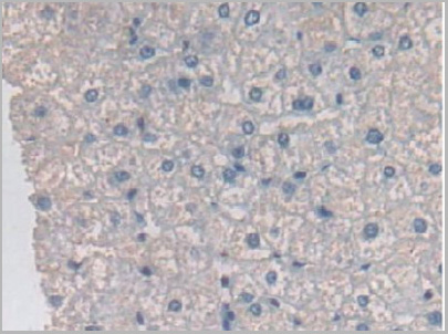 product-image-AAA20928_IHC7.jpg