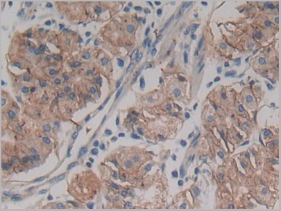 product-image-AAA20933_IHC3.jpg