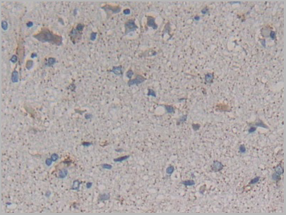 product-image-AAA20933_IHC4.png