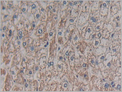 product-image-AAA20933_IHC5.png
