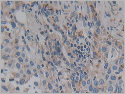 product-image-AAA20933_IHC6.png