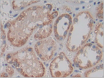 product-image-AAA20933_IHC7.png