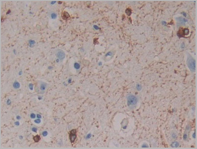 product-image-AAA20938_IHC5.jpg