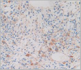 product-image-AAA20938_IHC6.jpg
