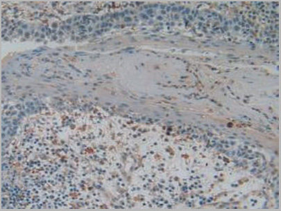 product-image-AAA20947_IHC3.jpg