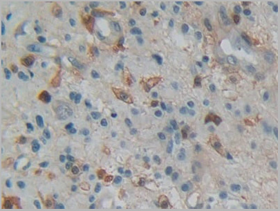 product-image-AAA20947_IHC4.jpg