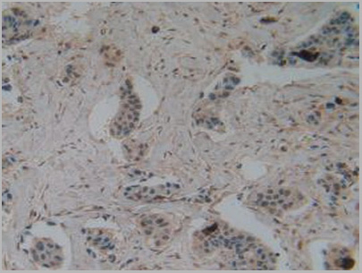 product-image-AAA20947_IHC5.jpg