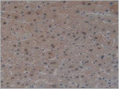 product-image-AAA20954_IHC2.jpg