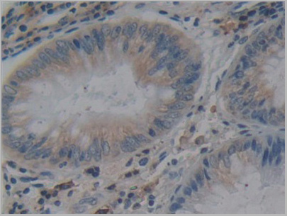 product-image-AAA20954_IHC3.jpg