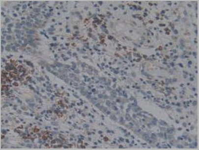 product-image-AAA20954_IHC4.jpg