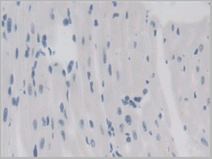 product-image-AAA20958_IHC6.png