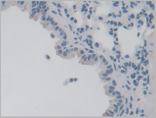 product-image-AAA20958_IHC7.png