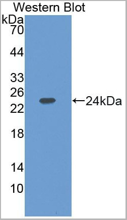 product-image-AAA20958_WB.jpg