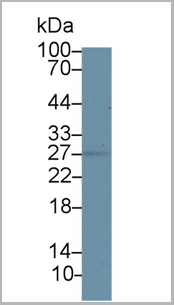 product-image-AAA20958_WB2.png