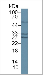 product-image-AAA20958_WB3.png