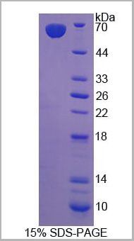 product-image-AAA20965_SDS_PAGE2.jpg
