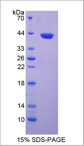 product-image-AAA20980_SDS_PAGE2.jpg