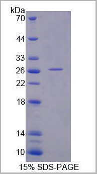 product-image-AAA20987_SDS_PAGE2.jpg
