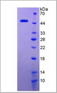 product-image-AAA20989_SDS_PAGE2.jpg