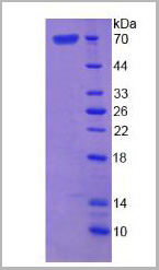 product-image-AAA20992_SDS_PAGE3.jpg