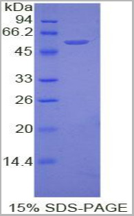 product-image-AAA20993_SDS_PAGE2.jpg