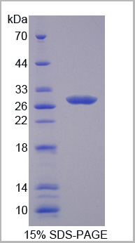 product-image-AAA20994_SDS_PAGE.jpg
