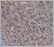 product-image-AAA21004_IHC4.jpg