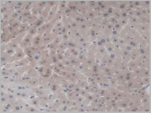 product-image-AAA21005_IHC3.jpg