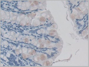 product-image-AAA21005_IHC4.jpg